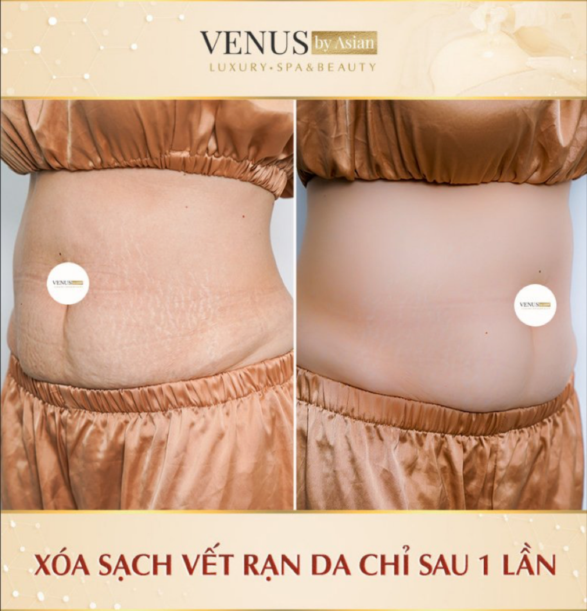 Phòng khám Venus By Asian - Địa chỉ làm đẹp uy tín tại Việt Nam năm 2021 Ảnh 5