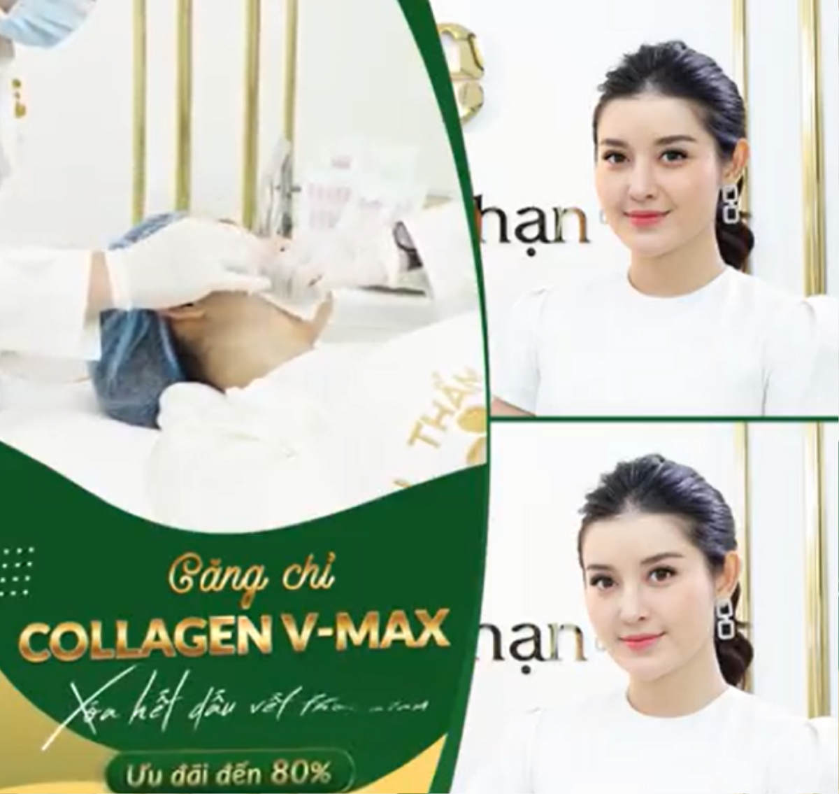 Á hậu Huyền My chia sẻ phương pháp trẻ hoá da bằng công nghệ Miracle BioCell – Tái sinh tế bào gốc tại Viện thẩm mỹ Quốc Tế Jinhae Ảnh 3