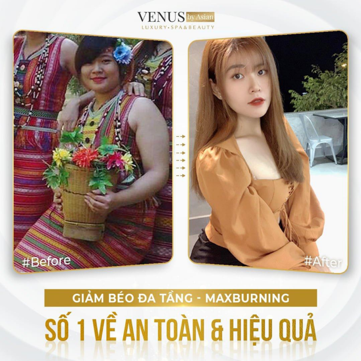 Chỉ với một buổi giảm béo tại Venus by Asian hiệu quả hơn 6 năm tập gym vất vả Ảnh 5