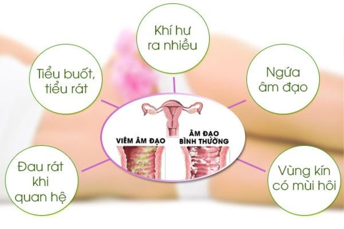 Bình Phụ An Khang – Lựa chọn hàng đầu cho sức khoẻ của chị em phụ nữ Ảnh 1