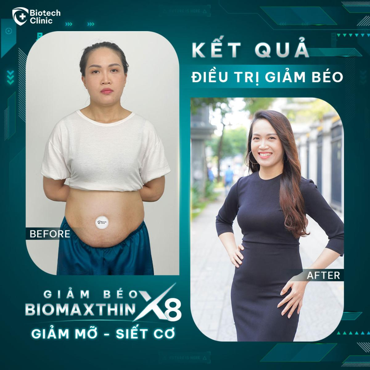 Giảm béo BioMaxthin - Công nghệ hủy mỡ siêu nhanh chuẩn châu Âu Ảnh 4