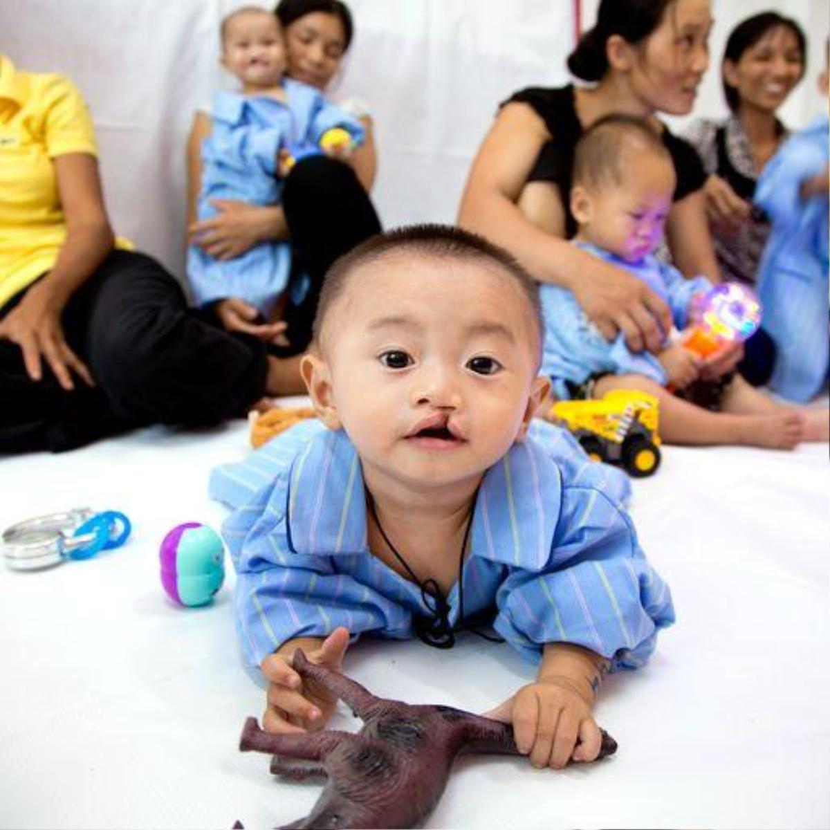 Corine de Farme kết hợp cùng tổ chức Operation Smile 'lan tỏa nụ cười trẻ thơ' Ảnh 1