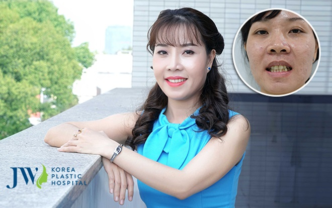 Nha khoa JW 'giảm giá siêu sốc' nhân dịp 30/4 & 1/5 Ảnh 2