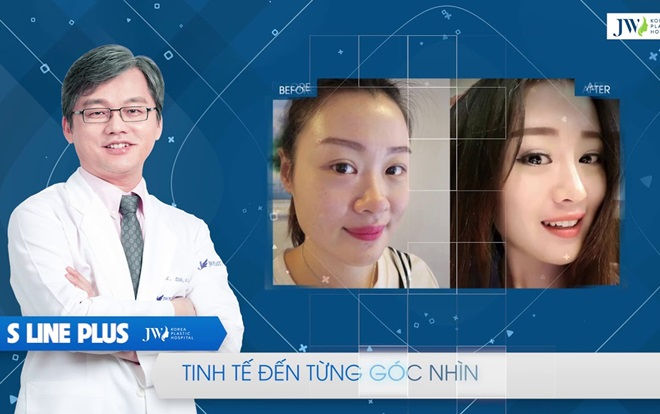 Nóng: Hỗ trợ 100% chi phí đối với những trường hợp làm mũi khó Ảnh 2