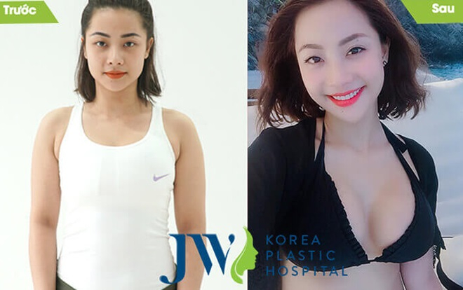 200 suất khuyến mãi dành cho khách hàng đăng ký nâng ngực Nano Chip giọt nước 4.0 Ảnh 2