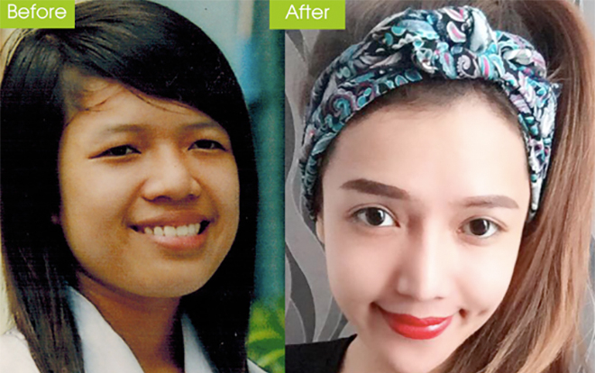 Top 10 'cực phẩm dao kéo' thành công nhất Việt Nam Ảnh 2