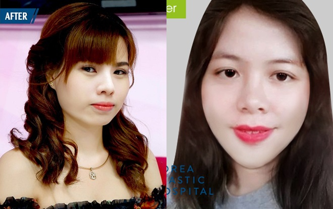 Chân dung 5 nhà giáo phẫu thuật điều trị khiếm khuyết để mang những gì tốt đẹp nhất đến cho học sinh Ảnh 2