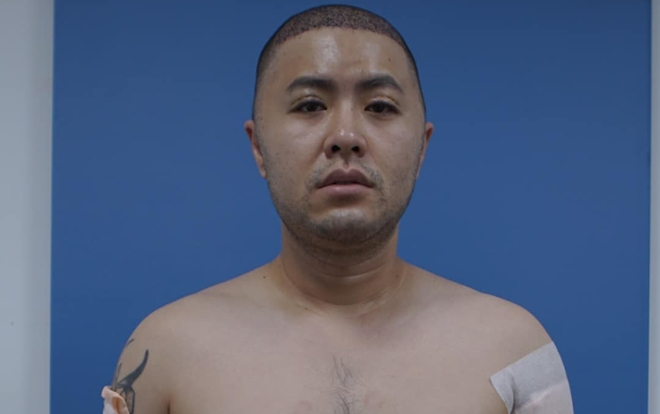 Đăng tải ảnh băng bó khắp người, Akira Phan phải chăng tiến hành cuộc 'đại trùng tu nhan sắc'? Ảnh 2