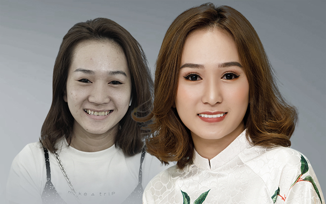 'Tốt nước sơn' sợ phán xét hay chối từ hạnh phúc Ảnh 2