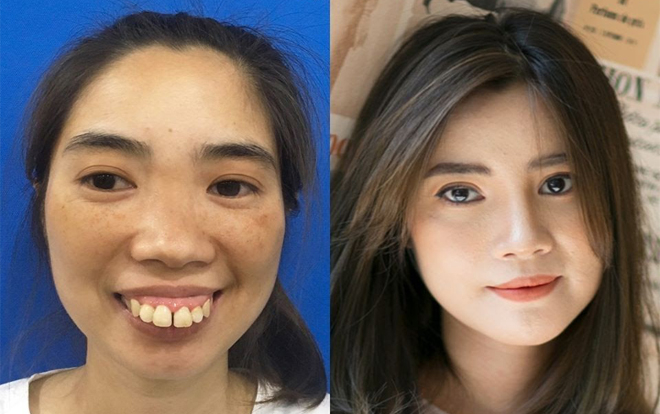 'Thị nở vạn người chê' lột xác khiến Hoàng Ku rung động: Sẽ có nhiều chàng trai xếp hàng chờ em Ảnh 2