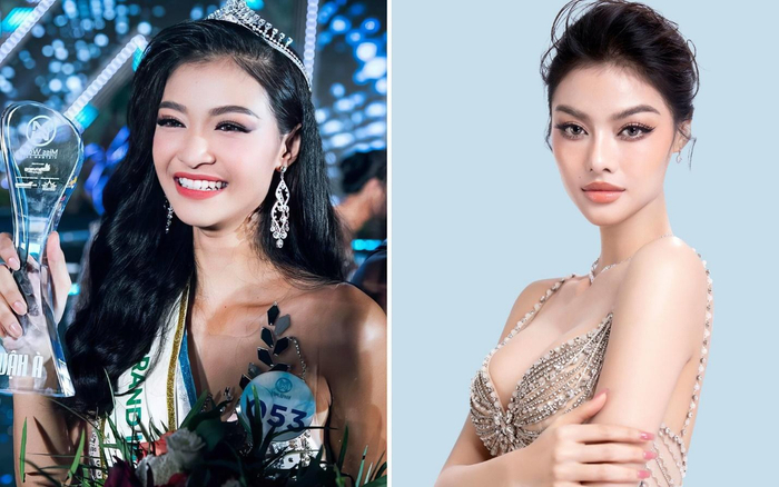 Bệnh viện thẩm mỹ Việt Mỹ: 'Trùm cuối' đứng sau nhan sắc thăng hạng của loạt người đẹp Vbiz Ảnh 2