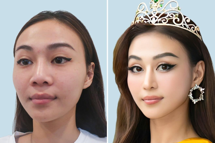 Sau khi thay đổi nhan sắc Trần Tuyết Như đã xuất sắc đạt danh hiệu Á Hậu Hòa Bình Việt Nam 2022