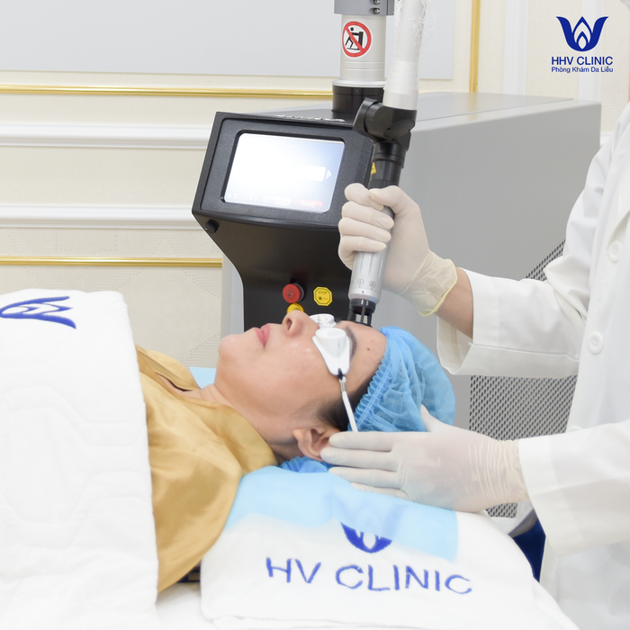 Bác sĩ trực tiếp điều trị nám cho khách hàng tại HHV Clinic