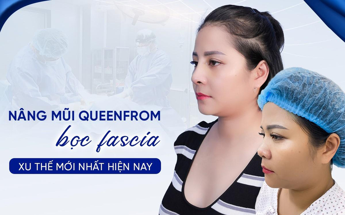Nâng mũi Queenform bọc Fascia đón đầu xu thế 'đẹp, an toàn, bền bỉ trọn đời' Ảnh 2