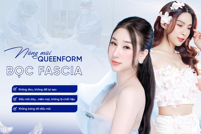 Thế mạnh của nâng mũi Queenform bọc Fascia