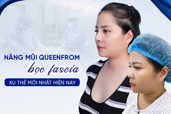 Nâng mũi Queenform bọc Fascia xu thế “đẹp, an toàn, bền bỉ trọn đời” mới nhất hiện nay