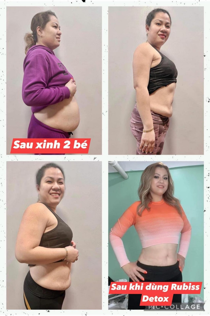 Phản hồi tích cực từ khách hàng của chị Yến sau khi sử dụng sản phẩm Rubiss Detox&nbsp;