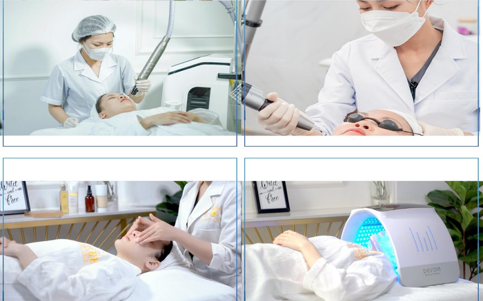 Bống Spa - Nơi đặt gót chân thiên đường làm đẹp với dịch vụ xóa nốt ruồi an toàn Ảnh 2