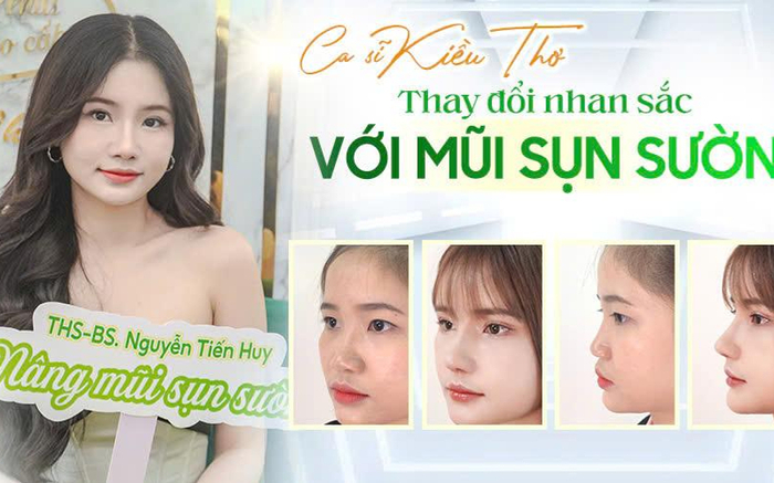 Ca sĩ Kiều Thơ: Thay đổi nhan sắc với mũi sụn sườn Ảnh 2