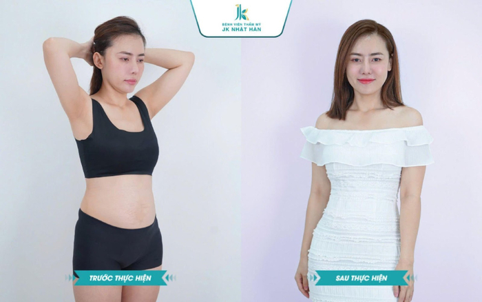 Giải pháp làm đẹp từ Bệnh viện Thẩm mỹ JK Nhật Hàn - Thương Hiệu Xuất Sắc Châu Á Thái Bình Dương Ảnh 2