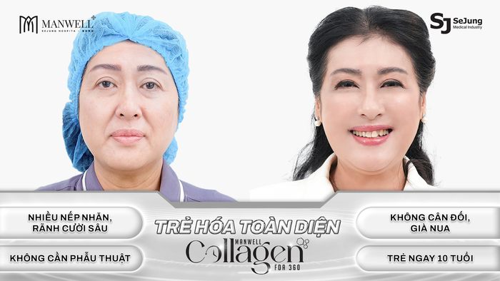 Viện trẻ hóa Manwell là người bạn đồng hành giúp NS Thanh Thủy giữ gìn hào quang của riêng mình&nbsp;