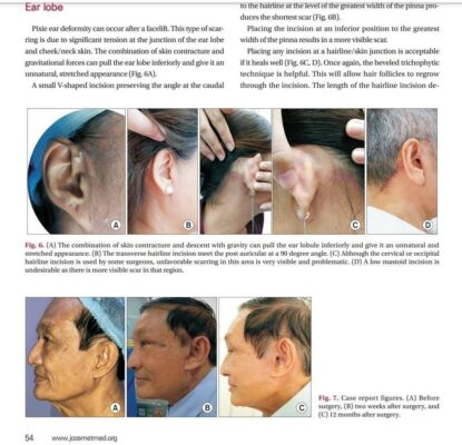 Nghiên cứu khoa học của Bác sĩ Nguyên Giáp được công bố trên tạp chí Y khoa