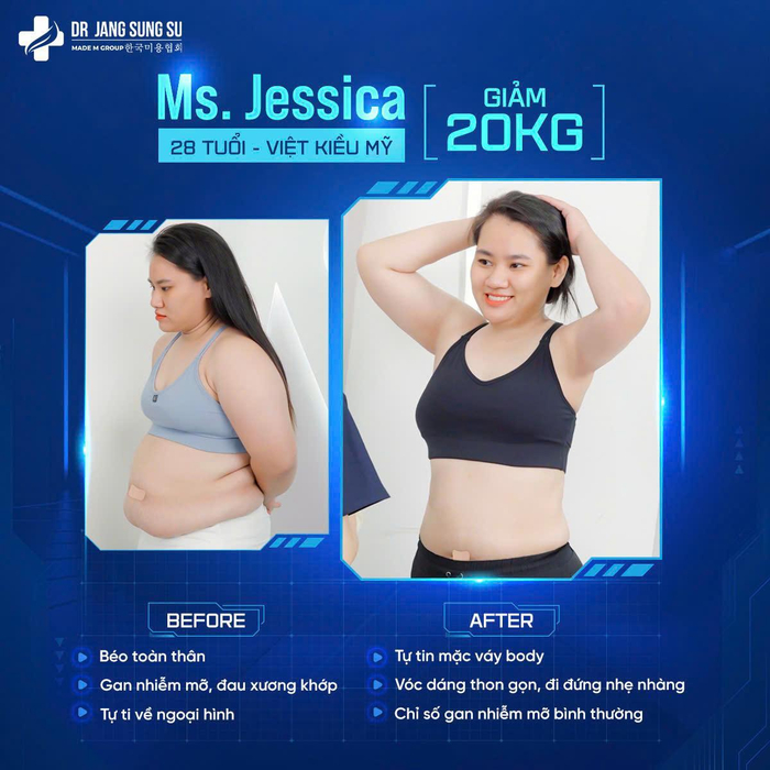 Ms. Jessica - Việt Kiều Mỹ, thành công giảm 20kg chỉ sau 1 liệu trình