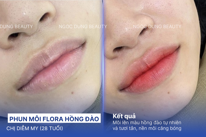 Kết quả phun môi flora màu hồng đào