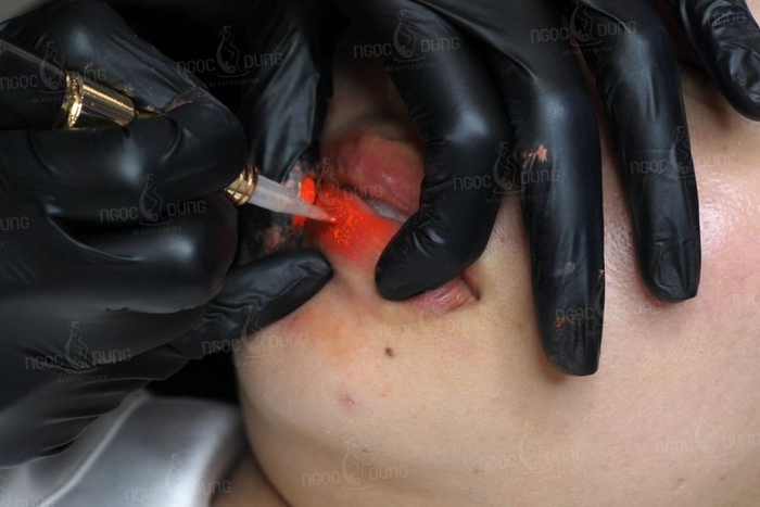 Phun môi Flora mang lại kết quả tự nhiên, phù hợp với xu hướng làm đẹp hiện đại