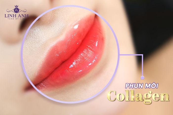 Phun môi giúp môi mềm mịn và loại bỏ tình trạng thâm sạm