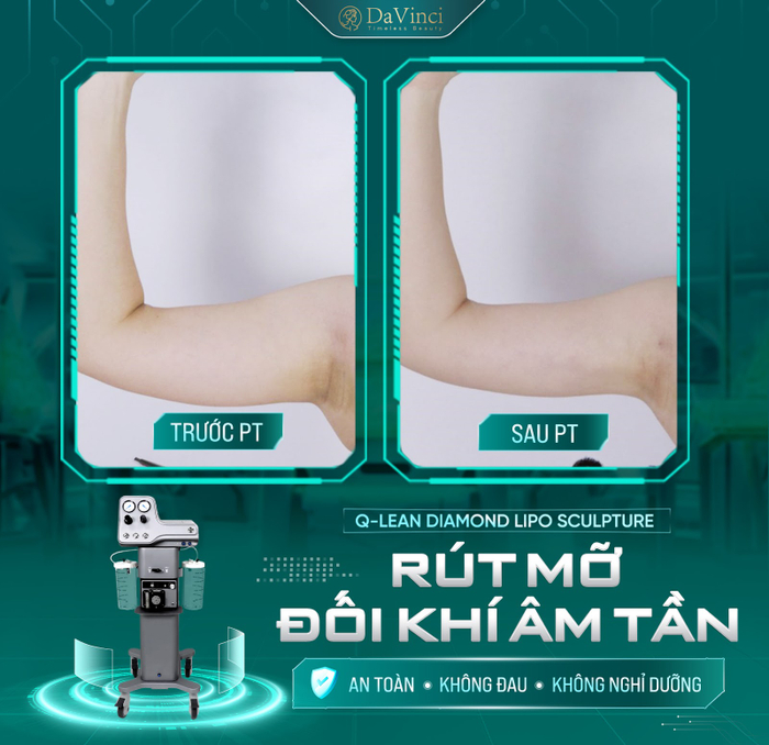 Bác Sĩ Trần Sinh Lục: Tiên phong ứng dụng công nghệ rút mỡ đối khí âm tần cho bắp tay thon gọn Ảnh 2