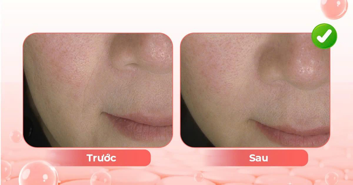 Lão hóa sắc tố là gì? Ảnh 1