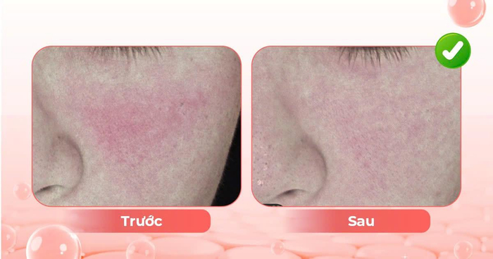 Lão hóa sắc tố là gì? Ảnh 4