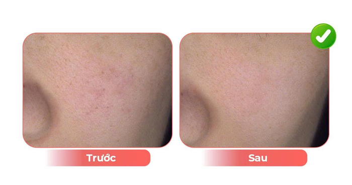 Lão hóa sắc tố là gì? Ảnh 3