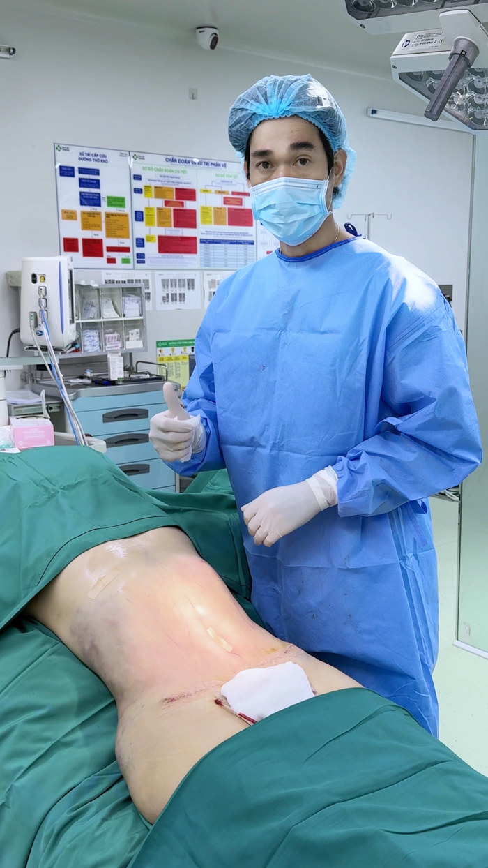 Hình ảnh vòng 2 thon gọn, sạch mỡ thừa sau khi phẫu thuật (Nguồn: Bác sĩ Huỳnh Tấn Đạt)