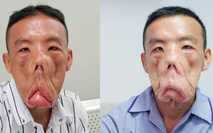 Anh Mến với gương mặt khác lạ, bác sĩ Tú Dung 'trần tình' Ảnh 2