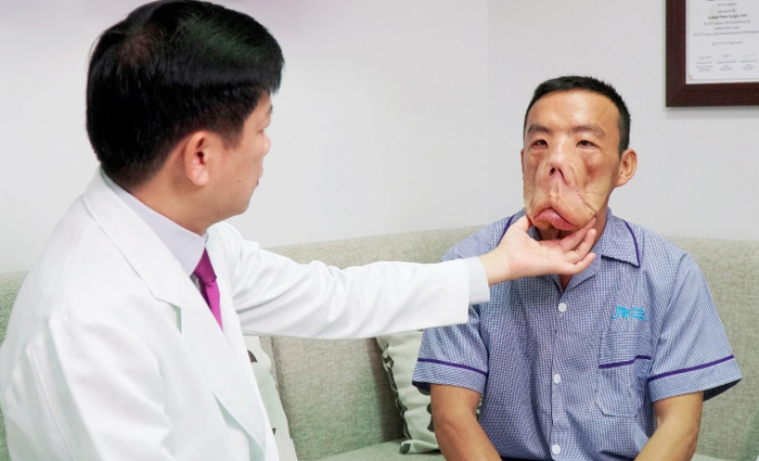 Phác đồ điều trị đặc biệt đã có những tác dụng rõ rệt với gương mặt chảy xệ của anh Mến