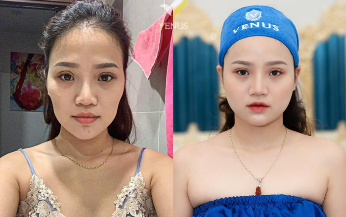 Công nghệ Tái sinh đa tầng duy trì được bao lâu? Ảnh 2