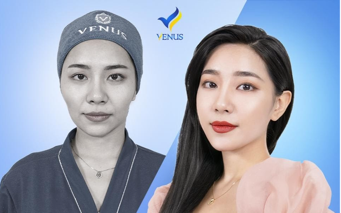 Tuyệt chiêu giảm cân không lo má tóp, hốc hác già nua. Ảnh 2