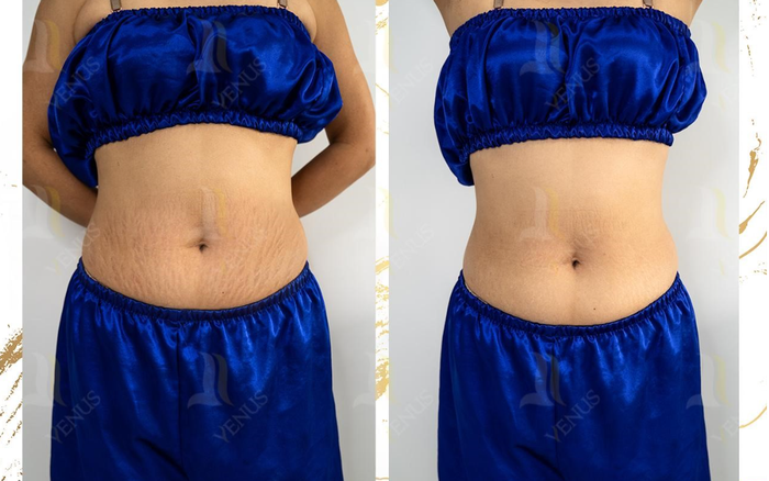 Khám phá siêu phẩm điều trị thành công hàng nghìn ca rạn nặng Ảnh 2