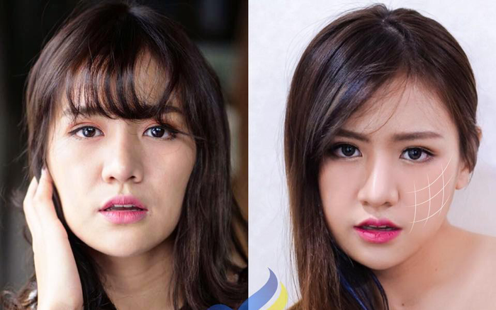 Tái sinh đa tầng bí quyết lấy lại 10 năm tuổi xuân của hàng ngàn phụ nữ Ảnh 2