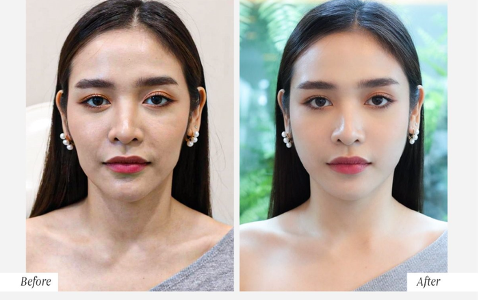 Tái sinh đa tầng lưu giữ thanh xuân tại Venus by Asian có tốt không? Ảnh 2