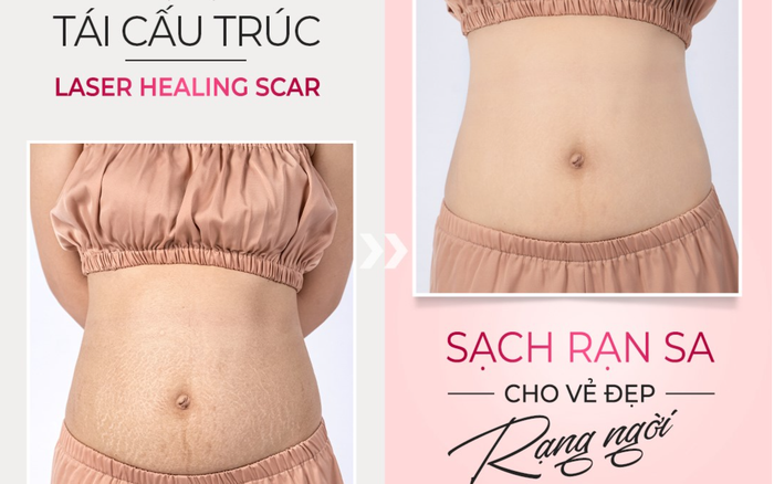 Công nghệ Tái cấu trúc Healing Scar dẫn đầu xu hướng trị rạn Ảnh 2