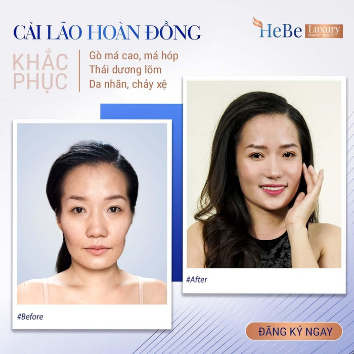 Top 3 phương pháp làm đẹp, trẻ hóa hàng đầu hiện nay Ảnh 5