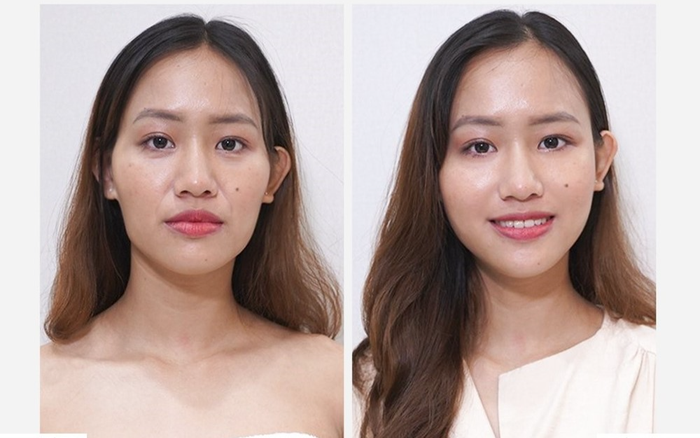 Phòng khám chuyên khoa phẫu thuật tạo hình thẩm mỹ Venus by Asian nơi Tâm - Tầm - Tài hội tụ Ảnh 2
