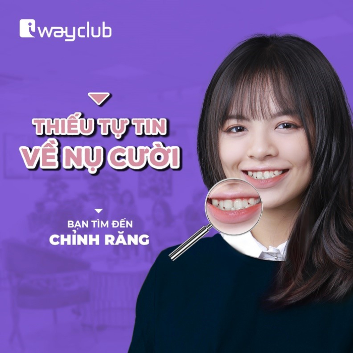 Công nghệ niềng răng trong suốt tại iWay Club cho nụ cười luôn xinh tươi Ảnh 3