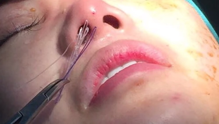 Sử dụng chỉ không rõ nguồn gốc, kém chất lượng