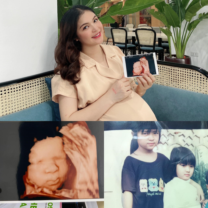 Ảnh siêu âm công chúa nhỏ được chị gái Hòa Minzy chia sẻ trên trang cá nhân