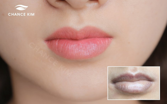 Bí quyết phun xăm môi tự nhiên không bong tại Chance Kim Ảnh 2