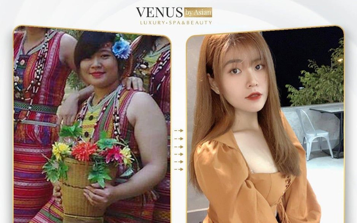 Chỉ với một buổi giảm béo tại Venus by Asian hiệu quả hơn 6 năm tập gym vất vả Ảnh 2
